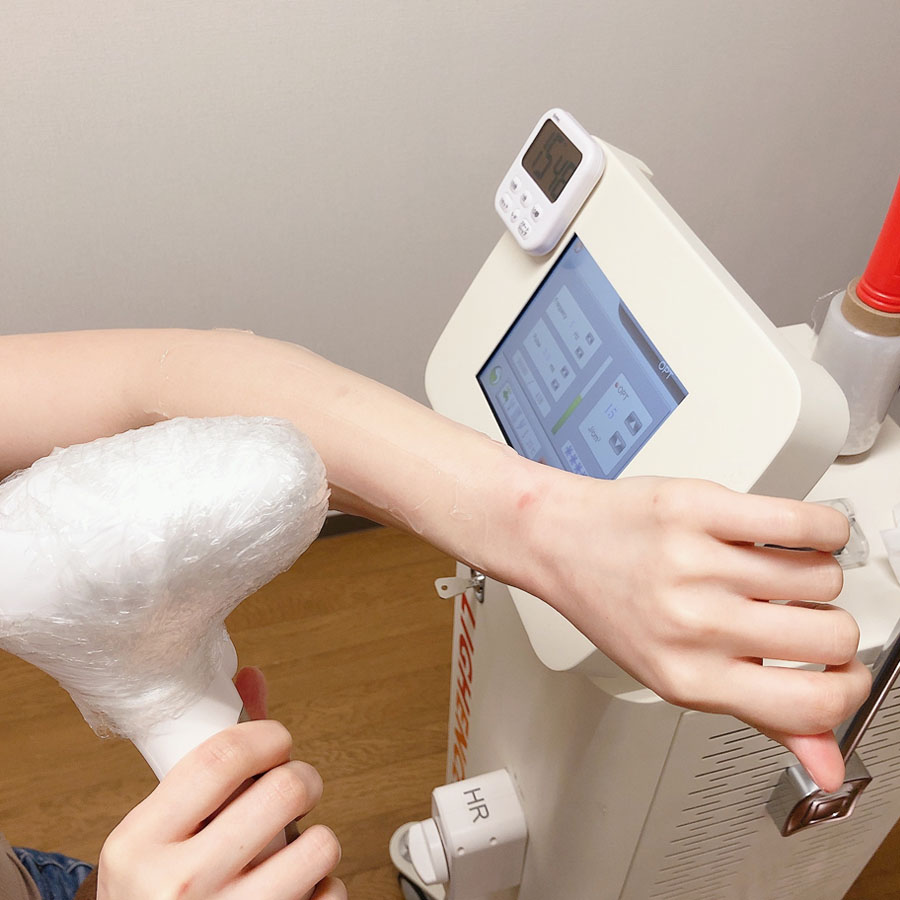 最新の脱毛機器を設置